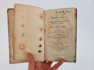 A CONCISE VIEW OF ALL THE MOST IMPORTANT FACTS WHICH HAVE HITHERTO APPEARED CONCERNING THE COW-POX