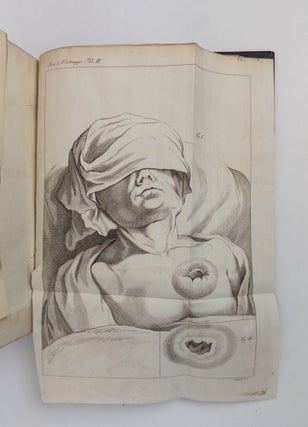 SCRIPTORUM LATINORUM DE ANEURYSMATIBUS COLLECTIO