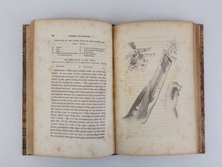 SURGERY ILLUSTRATED. COMPILED FROM THE WORKS OF CUTLER, HIND, VELPEAU, AND BLASIUS WITH FIFTY-TWO PLATES