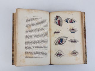 SURGERY ILLUSTRATED. COMPILED FROM THE WORKS OF CUTLER, HIND, VELPEAU, AND BLASIUS WITH FIFTY-TWO PLATES