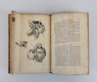 SURGERY ILLUSTRATED. COMPILED FROM THE WORKS OF CUTLER, HIND, VELPEAU, AND BLASIUS WITH FIFTY-TWO PLATES