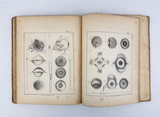 A CONDENSATION OF MATTER UPON THE ANATOMY, SURGICAL OPERATIONS AND TREATMENT OF DISEASES OF THE EYE, TOGETHER WITH REMARKS EMBELLISHED WITH TWELVE LITHOGRAPHIC PLATES, ILLUSTRATIVE OF THE ANATOMY, OPERATIONS, AND MORBID APPEARANCE
