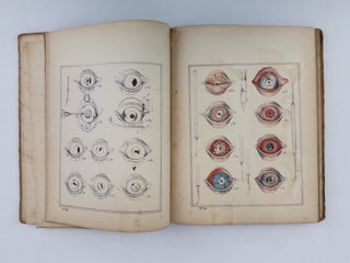 A CONDENSATION OF MATTER UPON THE ANATOMY, SURGICAL OPERATIONS AND TREATMENT OF DISEASES OF THE EYE, TOGETHER WITH REMARKS EMBELLISHED WITH TWELVE LITHOGRAPHIC PLATES, ILLUSTRATIVE OF THE ANATOMY, OPERATIONS, AND MORBID APPEARANCE