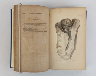A SYSTEM OF OPERATIVE SURGERY, FOUNDED ON THE BASIS OF ANATOMY [Two Volumes]