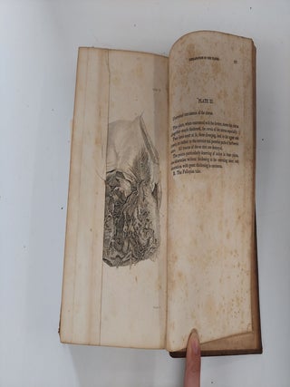 A TREATISE ON THE DISEASES OF FEMALES