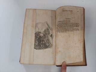 A TREATISE ON THE DISEASES OF FEMALES