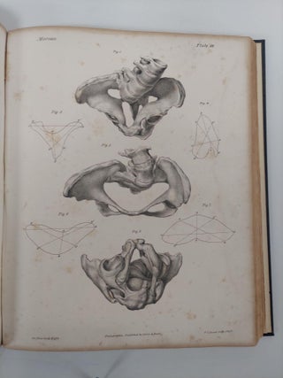 A PRACTICAL TREATISE ON MIDWIFERY: EXHIBITING THE PRESENT ADVANCED STATE OF THE SCIENCE. TRANSLATED FROM THE FRENCH WITH EIGHTY PLATES COMPRISING NUMEROUS SEPARATE ILLUSTRATIONS