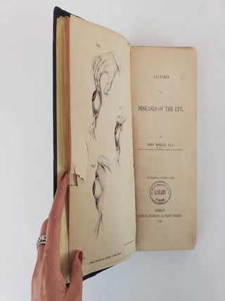 LECTURES ON DISEASES OF THE EYE. ILLUSTRATED BY COLOURED PLATES