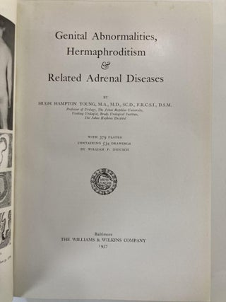 GENITAL ABNORMALITIES, HERMAPHRODITISM AND RELATED ADRENAL DISEASES