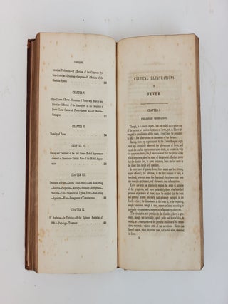 A TREATISE ON FEVER