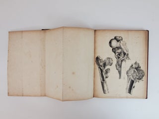 OBSERVATIONS ON INJURIES OF THE SPINE AND OF THE THIGH BONE: IN TWO LECTURES, DELIVERED IN THE SCHOOL OF GREAT WINDMILL STREET