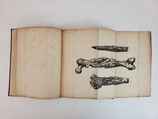 OBSERVATIONS ON INJURIES OF THE SPINE AND OF THE THIGH BONE: IN TWO LECTURES, DELIVERED IN THE SCHOOL OF GREAT WINDMILL STREET