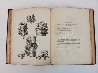 OBSERVATIONS ON INJURIES OF THE SPINE AND OF THE THIGH BONE: IN TWO LECTURES, DELIVERED IN THE SCHOOL OF GREAT WINDMILL STREET