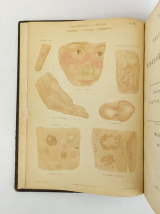 A THEORETICAL AND PRACTICAL TREATISE ON THE DISEASES OF THE SKIN