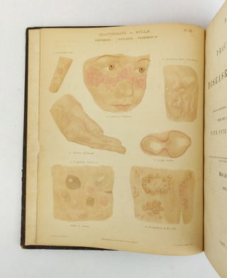 A THEORETICAL AND PRACTICAL TREATISE ON THE DISEASES OF THE SKIN