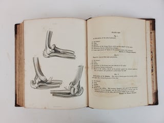 A TREATISE ON DISLOCATIONS AND FRACTURES OF THE JOINTS