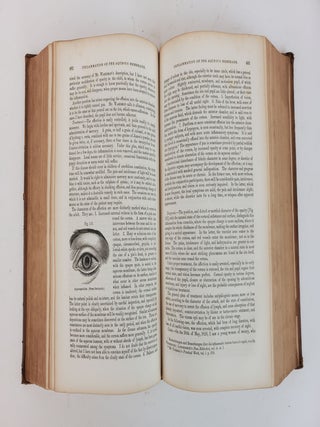 A TREATISE ON THE DISEASES OF THE EYE. EDITED WITH NUMEROUS ADDITIONS AND TWO HUNDRED AND FORTY-THREE ILLUSTRATIONS.