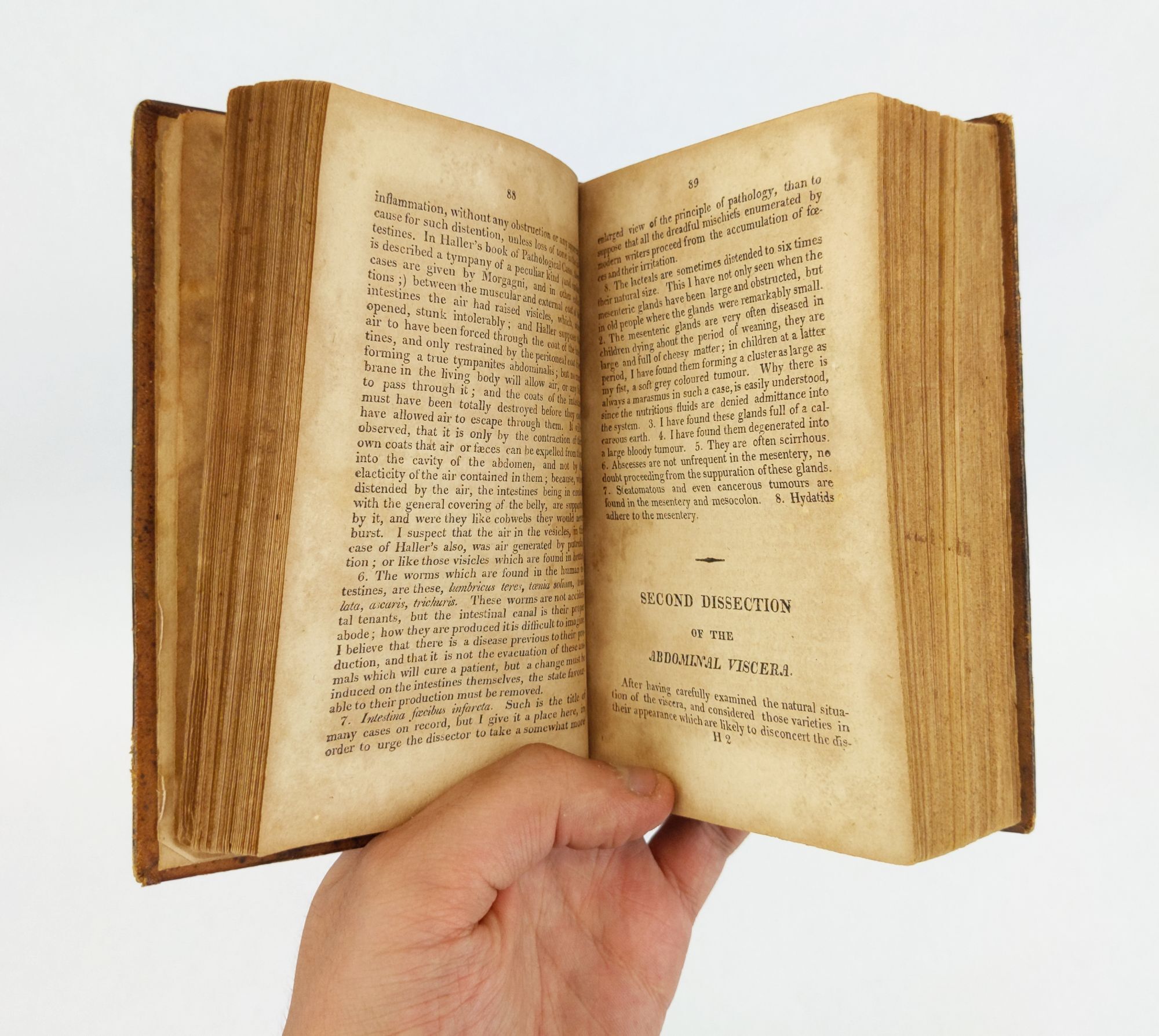 A SYSTEM OF DISSECTIONS, EXPLAINING THE ANATOMY OF THE HUMAN BODY. WITH ...