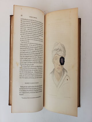 INSTITUTES AND PRACTICE OF SURGERY: BEING OUTLINES OF A COURSE OF LECTURES. IN TWO VOLUMES.
