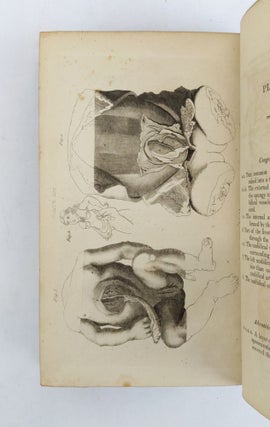 REMARKS AND PRACTICAL RESULTS OF OBSERVATION ON SCIRRHUS AND CANCER. TRANSLATED FROM THE ITALIAN