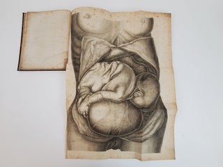 DE GRAVIDITATE ABDOMINALI, SINGULARI OBSERVATIONE AD TAB. IV. AENEAS ILLUSTRATA, CUM QUIBUSDAM AD HISTORIAM LITTERARIAM ADDITAMENTIS, HUC FACIENTIBUS