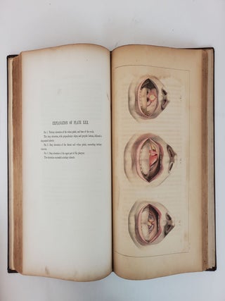 ILLUSTRATIONS OF SYPHILITIC DISEASE WITH THE ADDITION OF A HISTORY OF SYPHILIS, AND A COMPLETE BIBLIOGRAPHY AND FORMULARY OF REMEDIES. WITH FIFTY LARGE QUARTO PLATES, COMPRISING ONE HUNDRED AND SEVENTEEN BEAUTIFULLY COLORED ILLUSTRATIONS.