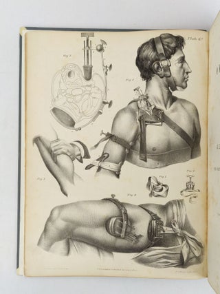 A TREATISE ON OPERATIVE SURGERY; COMPRISING A DESCRIPTION OF THE VARIOUS PROCESSES OF THE ART, INCLUDING ALL THE NEW OPERATIONS ; EXHIBITING THE STATE OF SURGICAL SCIENCE IN ITS PRESENT ADVANCED CONDITION: WITH EIGHTY PLATES CONTAINING FOUR HUNDRED AND EIGHTY-SIX SEPARATE ILLUSTRATIONS