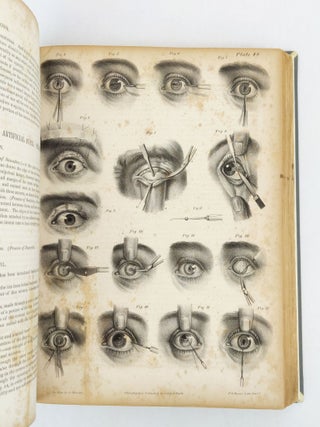 A TREATISE ON OPERATIVE SURGERY; COMPRISING A DESCRIPTION OF THE VARIOUS PROCESSES OF THE ART, INCLUDING ALL THE NEW OPERATIONS ; EXHIBITING THE STATE OF SURGICAL SCIENCE IN ITS PRESENT ADVANCED CONDITION: WITH EIGHTY PLATES CONTAINING FOUR HUNDRED AND EIGHTY-SIX SEPARATE ILLUSTRATIONS