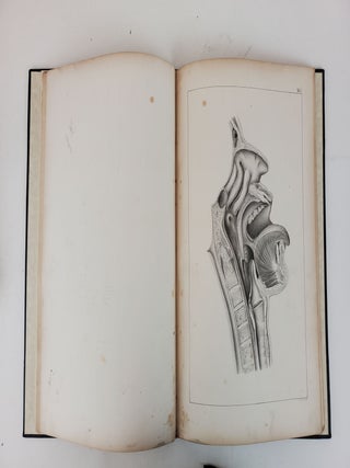 ATLAS ZUR LARYNGOSKOPIE UND LARYNGOSKOPISCHEN CHIRURGIE