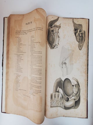 THE ANATOMY AND SURGICAL TREATMENT OF CRURAL AND UMBILICAL HERNIA, &C. &C. ILLUSTRATED BY PLATES. PART II [PART TWO ONLY]
