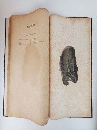 THE ANATOMY AND SURGICAL TREATMENT OF CRURAL AND UMBILICAL HERNIA, &C. &C. ILLUSTRATED BY PLATES. PART II [PART TWO ONLY]
