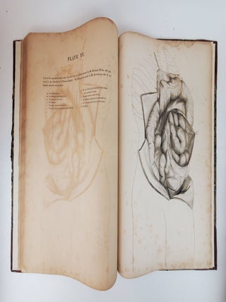 THE ANATOMY AND SURGICAL TREATMENT OF CRURAL AND UMBILICAL HERNIA, &C. &C. ILLUSTRATED BY PLATES. PART II [PART TWO ONLY]