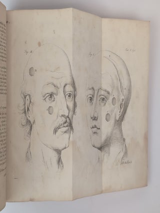 MEDICAL, CHIRURGICAL, AND ANATOMICAL CASES AND OBSERVATIONS