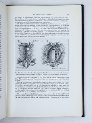 INTRACRANIAL TUMOURS