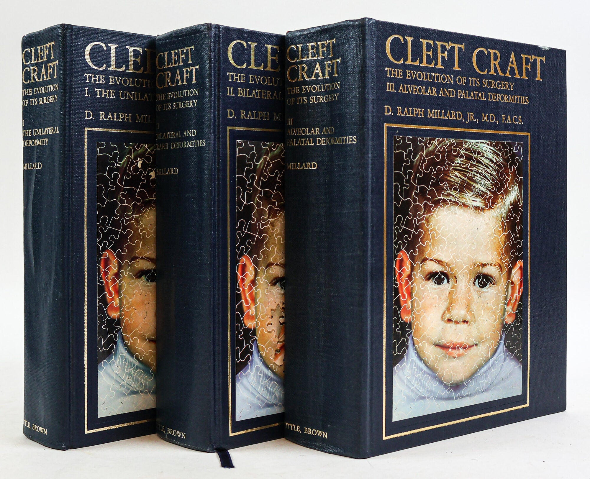 CLEFT CRAFT: THE EVOLUTION OF ITS SURGERY Three Volumes, Complete ...