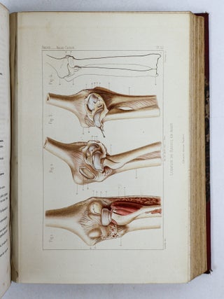 TRAITÉ ICONOGRAPHIQUE DES MALADIES CHIRURGICALES